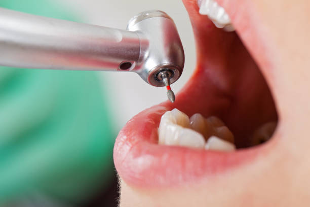 Best Cracked Tooth Emergency Dentist  in Monroe, WA
